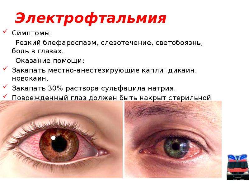 Боль в глазах. боль в глазном яблоке. лечение глазной боли в клинике «эхинацея». нейроофтальмолог - медицинский центр «эхинацея»